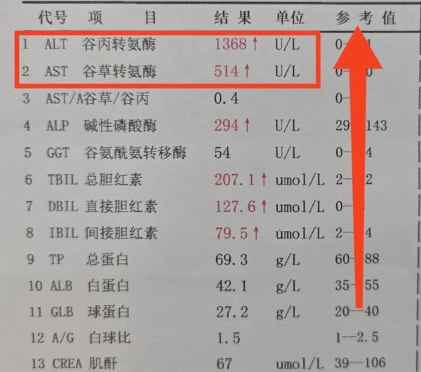 体检查出转氨酶升高，是肝病吗？这几个原因很常见，没必要太焦虑